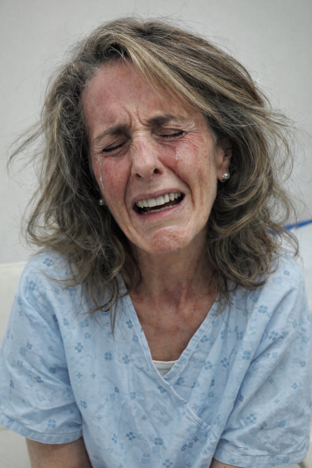 Paziente con sclerosi multipla e dolore trigeminale